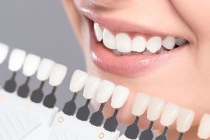 a woman smiling with a model of different shades of teeth for dental veneers