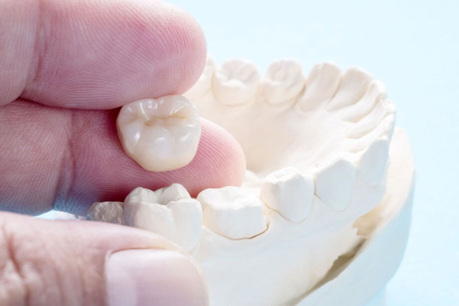 person holding a dental crown
